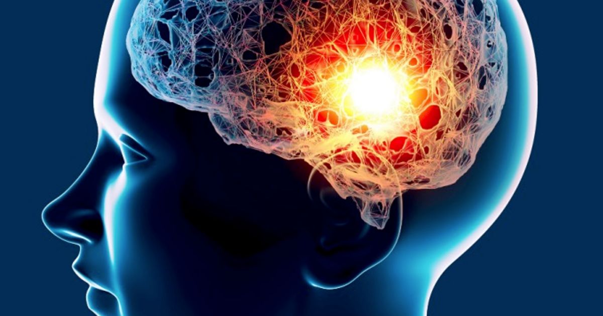 Actinogen Medical advances pivotal XanaMIA trial towards November readout - ICYMI